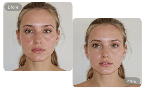 Automatic Blemish Detection with AI Technology