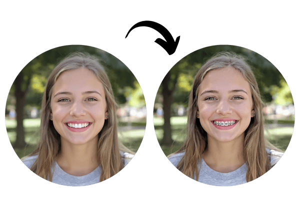 Realistic AI Braces Filter Technology