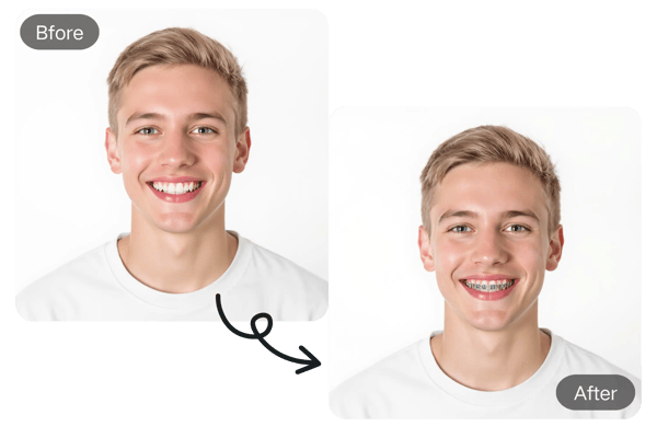 Virtual Braces Try-On Before Orthodontic Treatment